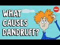 Can Dandruff Cause Eyebrow Loss