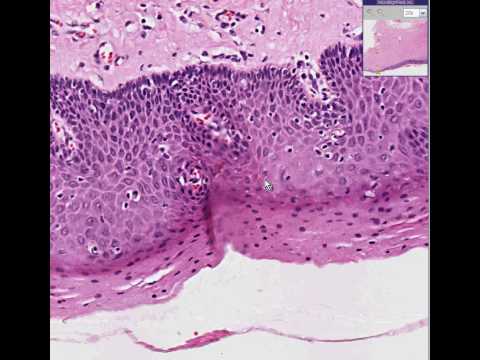 vulva