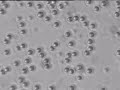 Photodynamic Therapy