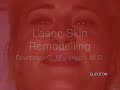 Antiageing: laser photorejuvenation non invasive treatment for wrinkles