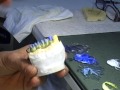 occlusal and palatal surfaces involved with Incisal layout procedure