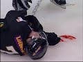 Lance Ward big hits on Stefan Erkg�rds(Bloody)