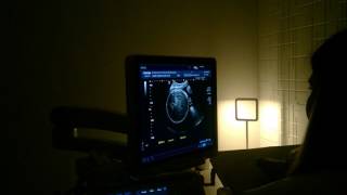 Ultra 34 semanas + 6 dias - Clínica Cors, Ettiene Mattos