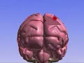Impact of Migraines on Children