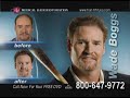 Hair transplant cost