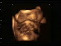 3d-4d-ultrasonografia-maos-face-rosto-feto