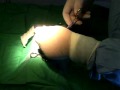 Dog Spay Part 1