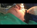Diego Norway Klinikk Stavanger Facial Cosmetic Surgery Diego Norway Klinikk Stavanger Facial Cosmetic Surgery