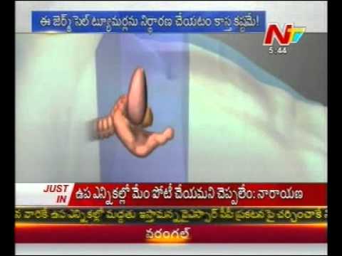 Special Focus On Yuvraj Singhs cancer    02