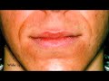 Part 1 The Upstream Brass Embouchure