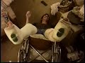 road rebel getting a leg up in two full leg casts