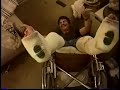 road rebel getting a leg up in two full leg casts