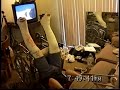 road rebel getting a leg up in two full leg casts