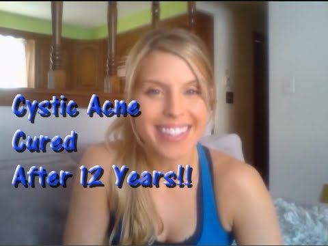 how to cure cystic pimple