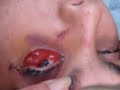 bobos eye bobos eye