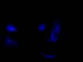 My car lights