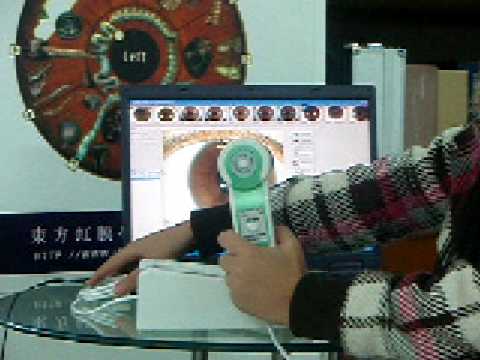 iriscopio - 1. Have six lights in the lens 2. Switch from two lights to four 3. Four lights in the pupil, another lights on the colon ring. Can take more clear and integ...