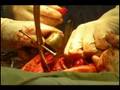 videos de Medicine in Moldova - Медицина в Молдове