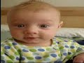 Toddler Battles Type 1 Diabetes
