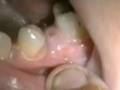 Curas video 3 Clovis pereira