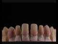 Odontologia Estética 02 – Dr. Rogério Marcondes – Curitiba / PR / Brasil