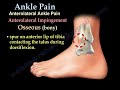Ankle Pain, ankle ligaments sprain - Everything You Need To Know - Dr. Nabil Ebraheim