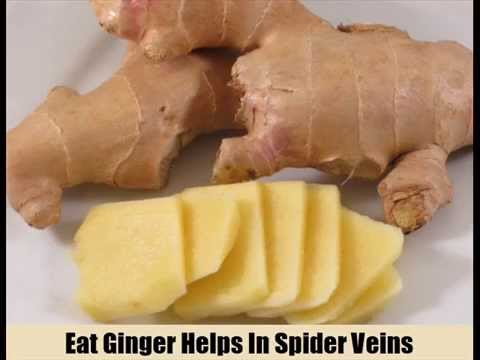 how to cure spider veins