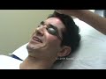 Laser Acne Scar Removal with Our Skin Resurfacing Treatment