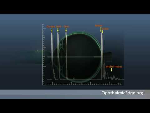 how to perform b scan