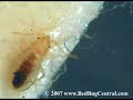 Bed Bug Nymph Digesting a Blood Meal Bed Bug Nymph Digesting a Blood Meal