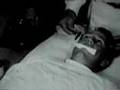 Electroconvulsive therapy (ECT)