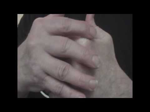how to cure rheumatism