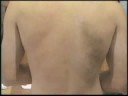 Alexandria Professional Body Sugaring is a safe,  gentle and effective solution to hair removal for women,  men and children. Professional Body Sugaring offers numerous unique and diverse benefits. The most important advantage is very fundamental:  the sugar paste extracts hair in its natural direction of growth and does so when the hair is still in the early growth stage,  eliminating breakage,  unnecessary discomfort,  irritation and ingrown hairs while exfoliating dry skin cells. The result:  smooth,  beautiful skin,  without the discomforts of other hair removal techniques.