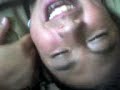 Cosqillaz al pelon