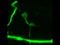Axon outgrowth