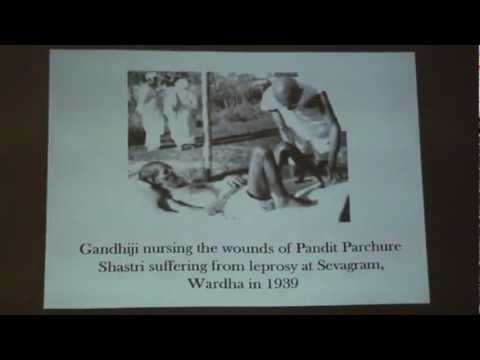 how to treat bcg vaccine