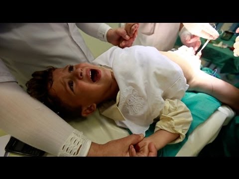 ألمانيا تسمح للمسلمين بإجراء عمليات الختان - فيديو