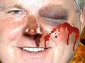 Punch Rush Limbaugh!!