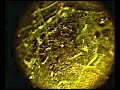 morgellons nano-transmitters #3 green light