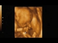 Baby girl Thompson