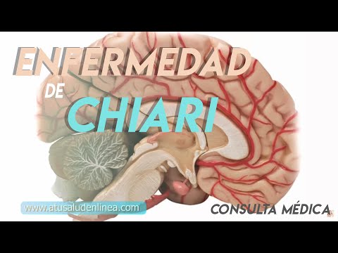 Micro: Enfermedad de Chiari o Malformación de Arnold Chiari.