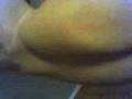 Bicep