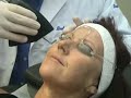 Sarasota Dermatologist - Fractional CO2 Laser Treatment Sarasota Dermatologist - Fractional CO2 Laser Treatment