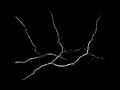 Structured illumination of Neuronal Cells Structured illumination of Neuronal Cells