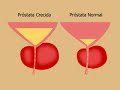 Prostata Vital by ProstataVital.com Part 1