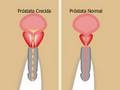 Prostata Vital by ProstataVital.com Part 1