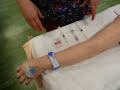 Medication Through Saline Lock
