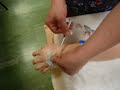 Medication Through Saline Lock