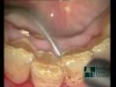 Igiene orale con microscopio