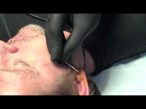 EXCENTRIK TATTOO PIERCING SCARIFICATION Stretching Eric Dube's Earlobes